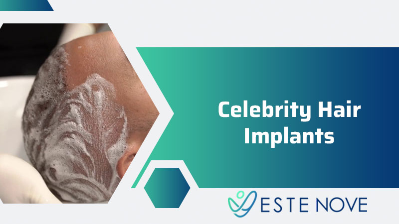 Celebrity Hair Implants