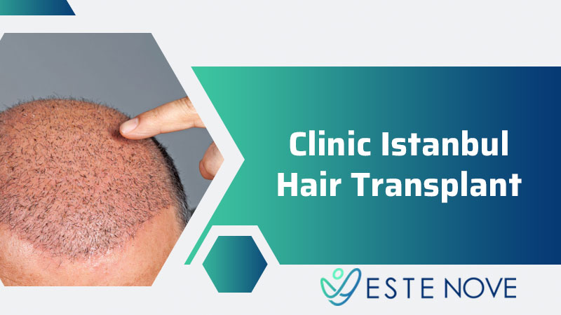 Clinic Istanbul Hair Transplant - Estenove Clinic Istanbul Hair Transplant - Estenove