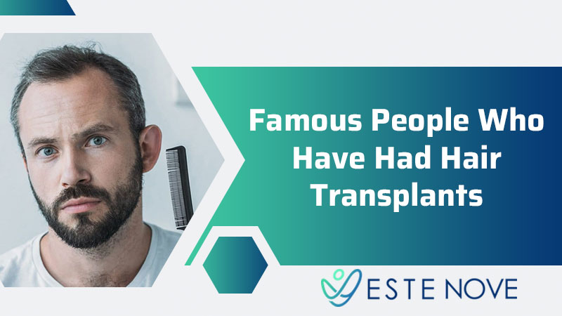 Famous People Who Have Had Hair Transplant - Estenove