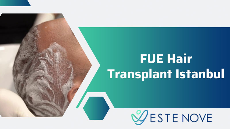 Fue Hair Transplant Istanbul