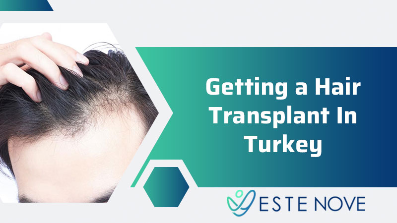 Getting A Hair Transplant In Turkey