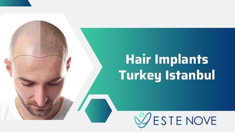 Hair Implants Turkey Istanbul