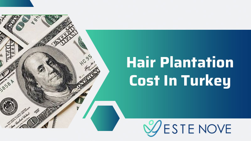 Hair Plantation Cost In Turkey