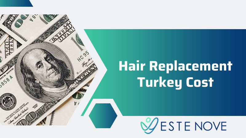 Hair Replacement Turkey Cost