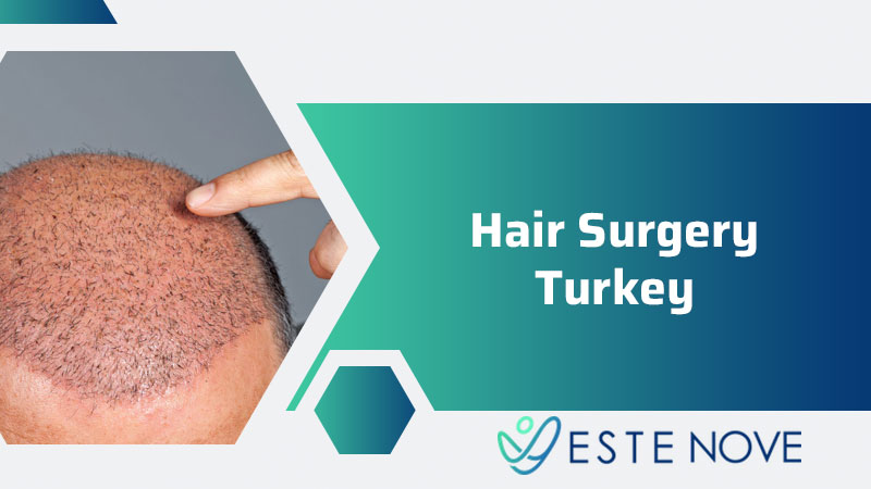 Hair Surgery Turkey