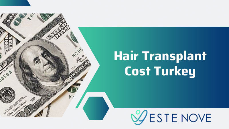 Hair Transplant Cost Turkey