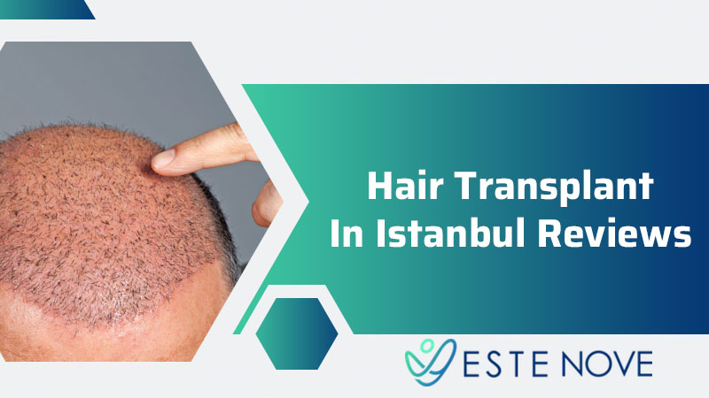 Hair transplant In Istanbul Reviews