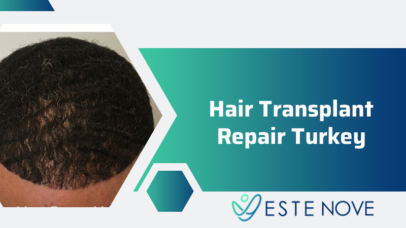 Hair Transplant Repair Turkey