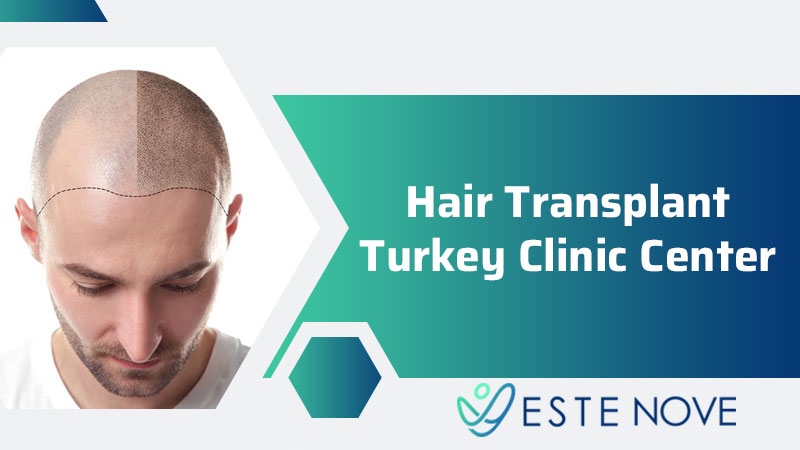 Hair Transplant Turkey Clinic Center - Estenove