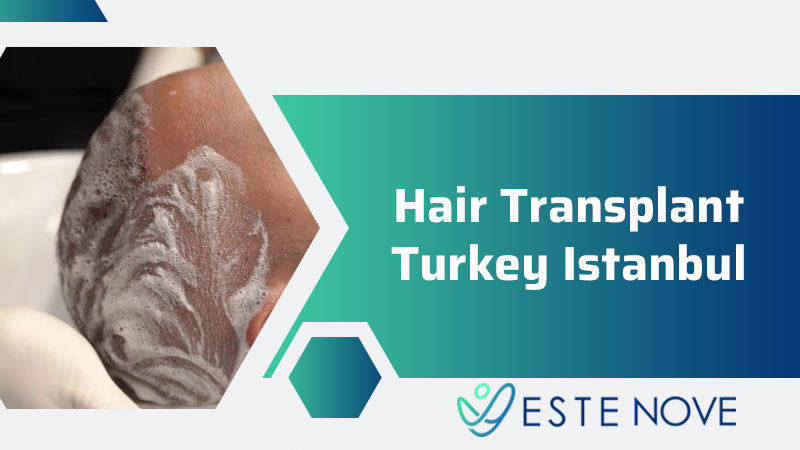 Hair Transplant Turkey Istanbul