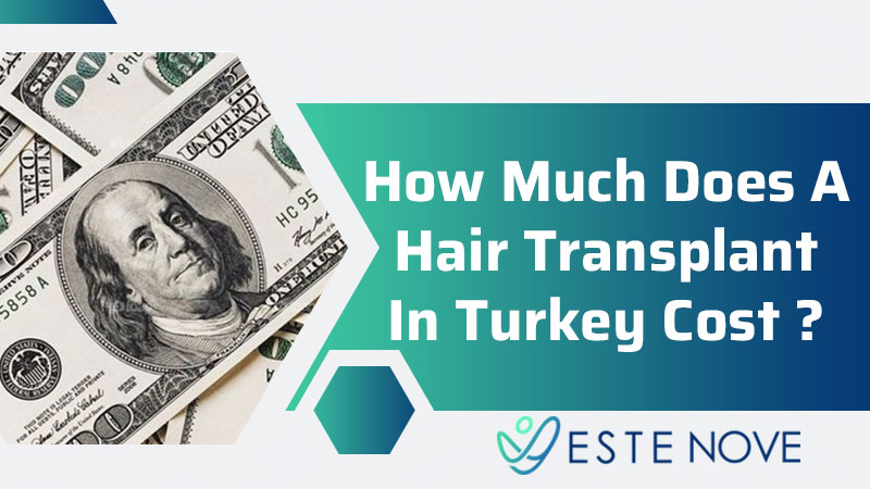 How Much Does A Hair Transplant In Turkey Cost?