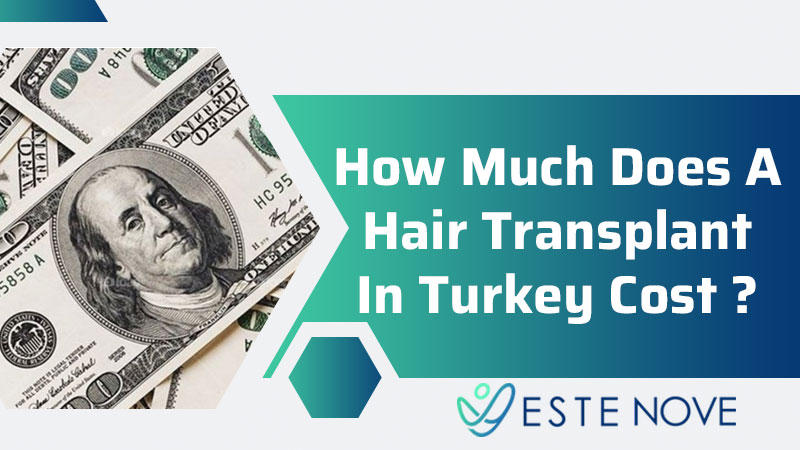 How Much Does a Hair Transplant In Turkey Cost?