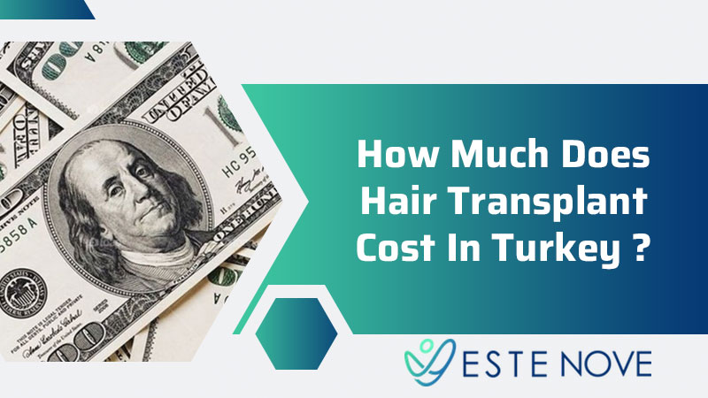 How Much Does Hair Transplant Cost In Turkey?