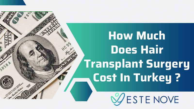 How Much Does Hair Transplant Surgery Cost In Turkey?