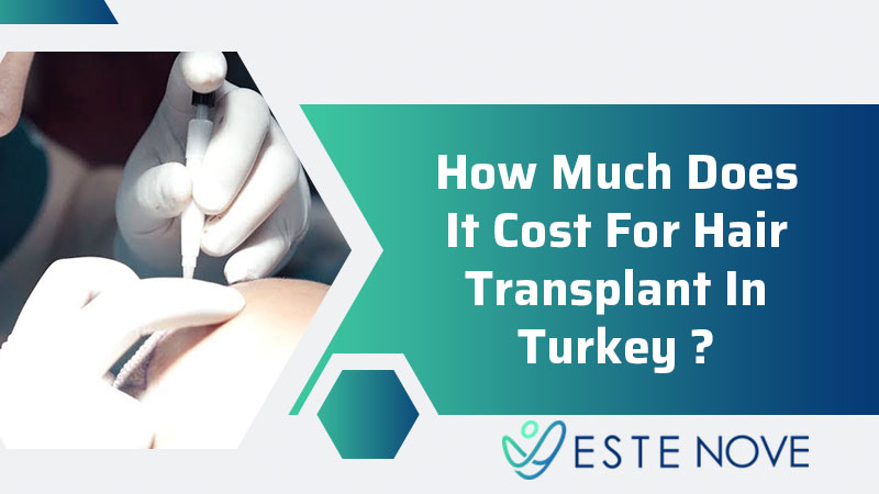 How Much Does It Cost For Hair Transplant?