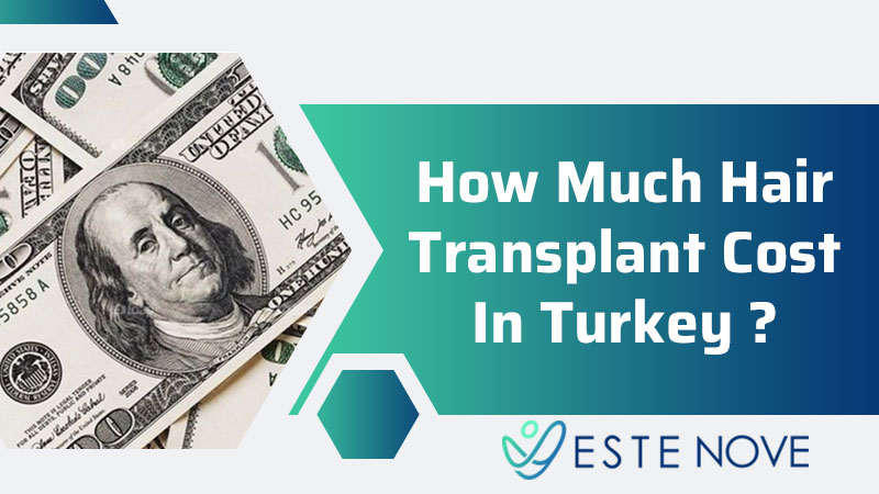 How Much Hair Transplant Cost In Turkey?