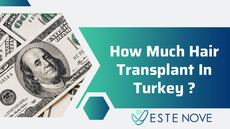 How Much Hair Transplant In Turkey