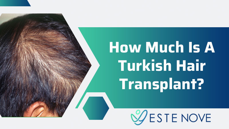How Much Is A Turkish Hair Transplant?