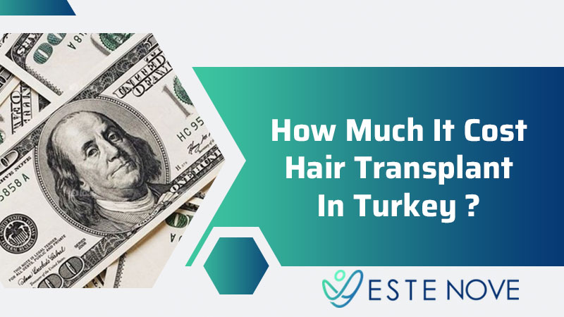 How Much It Cost Hair Transplant In Turkey - Estenove