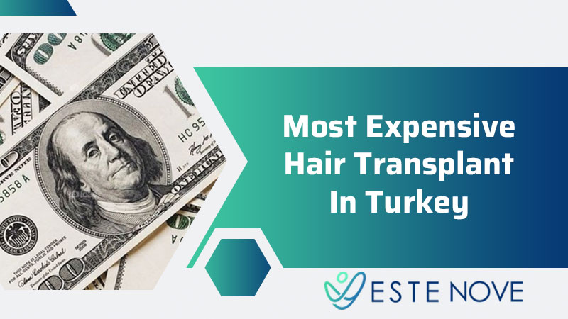 Most Expensive Hair Transplant In Turkey