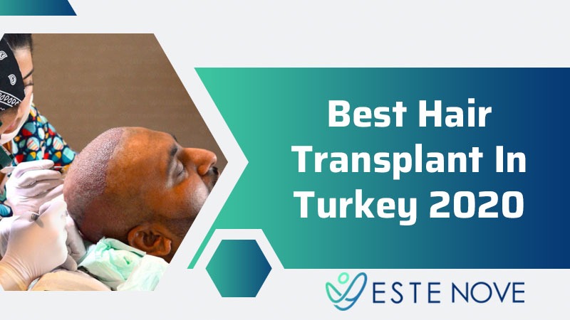 Best Hair Transplant In Turkey 2020