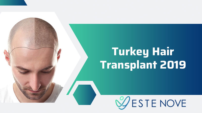 Turkey Hair Transplant 2019