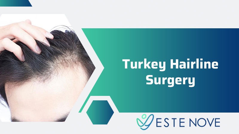 Turkey Hairline Surgery