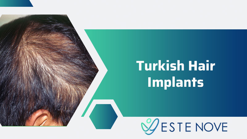 Turkish Hair