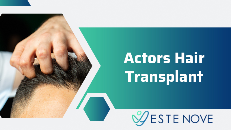 Actors Hair Transplant - Estenove