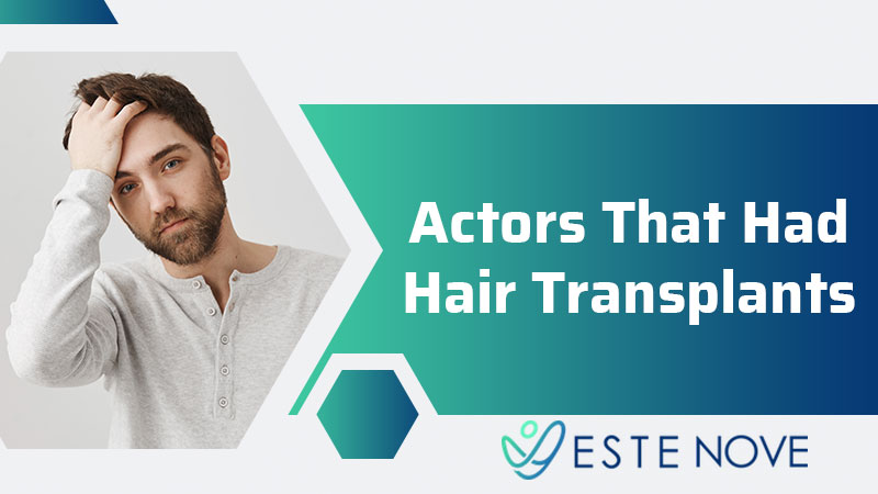 Actors That Had Hair Transplants - Estenove