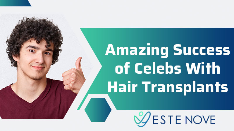 Amazing Success of Celebs With Hair Transplants