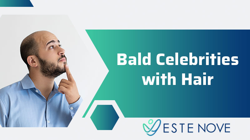 Bald Celebrities With Hair