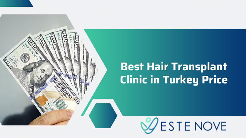 Best Hair Transplant Clinic in Turkey Price