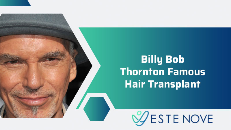 Billy Bob Thornton Famous Hair Transplant