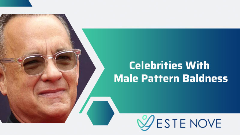 Celebrities With Male Pattern Baldness