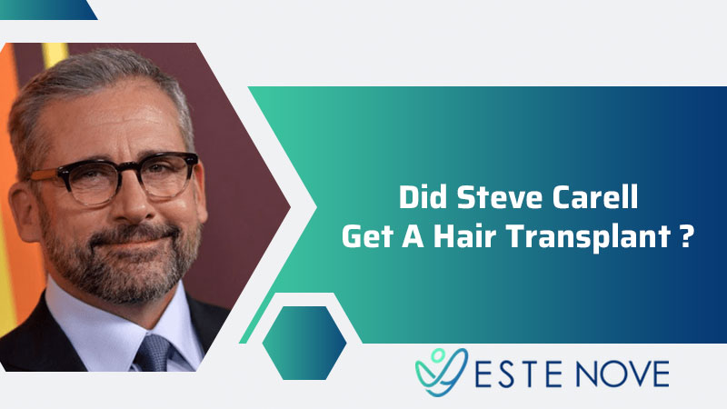 Did Steve Carell Get A Hair Transplant