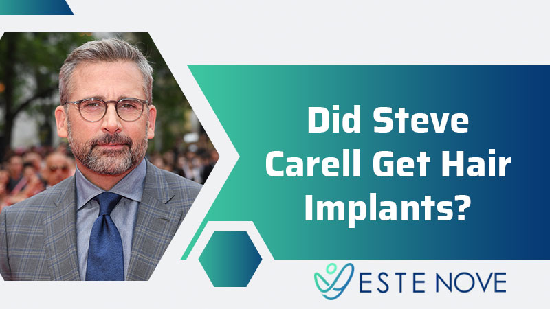 Did Steve Carell Get Hair Implants