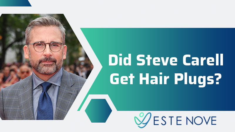 Did Steve Carell Get Hair Plugs