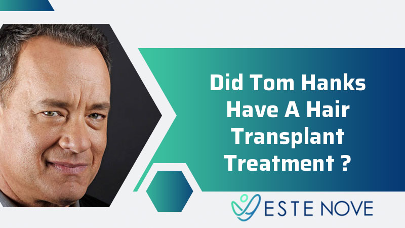 Did Tom Hanks Have A Hair Transplant Treatment?