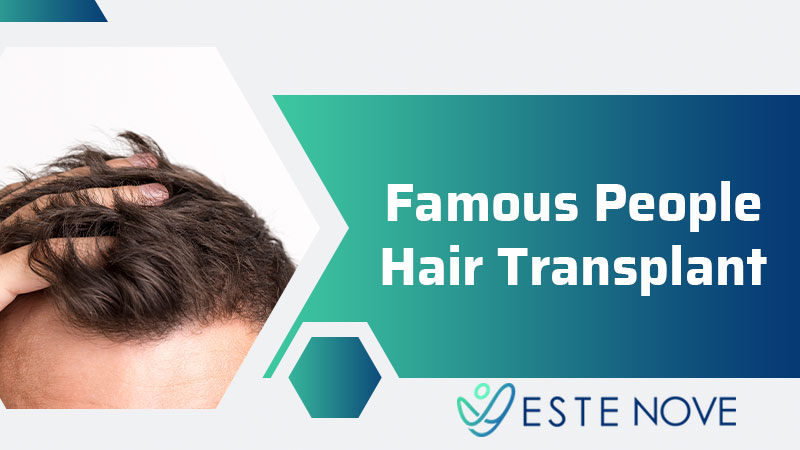 Famous People Hair Transplant