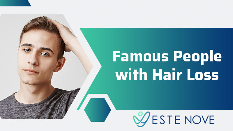 Famous People With Hair Loss