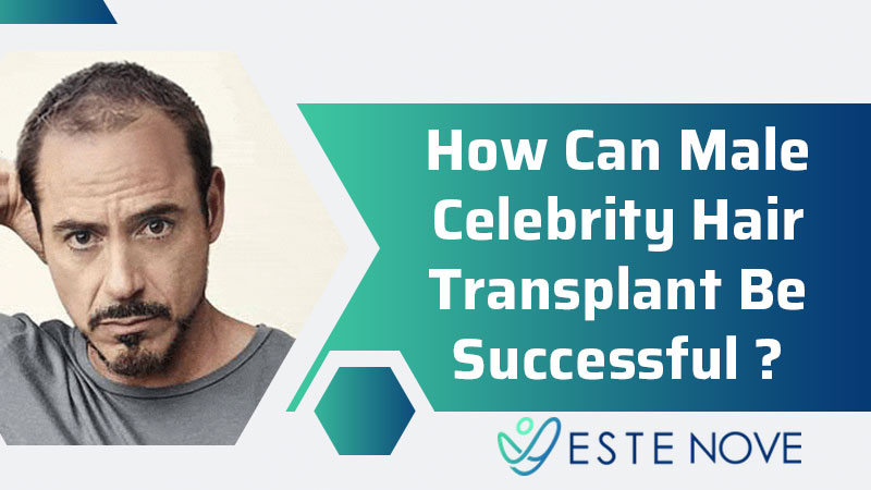 How Can Male Celebrity Hair Transplant Be Successful?
