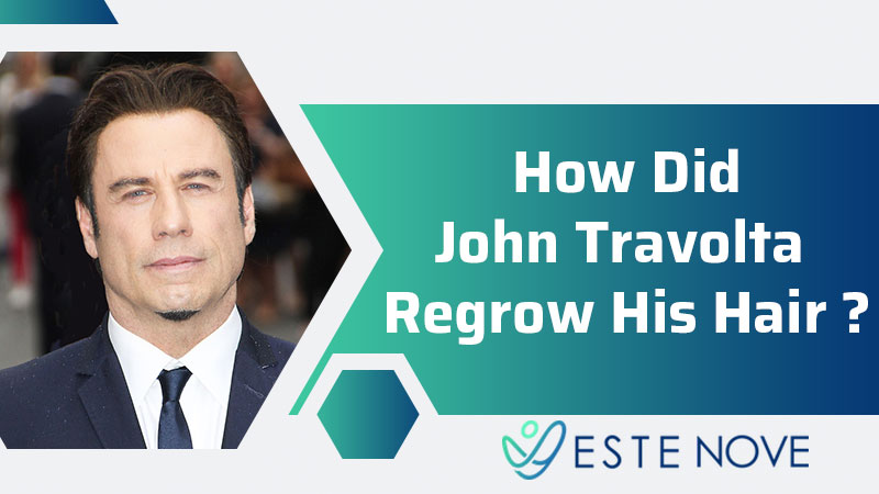 How Did John Travolta Regrow His Hair?