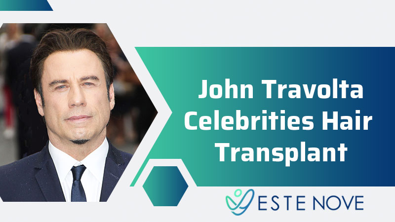 John Travolta Celebrities Hair Transplant