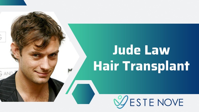 Jude Law Hair Transplant