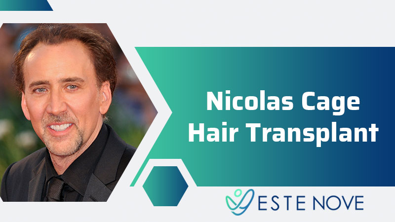 Nicolas Cage Hair Transplant