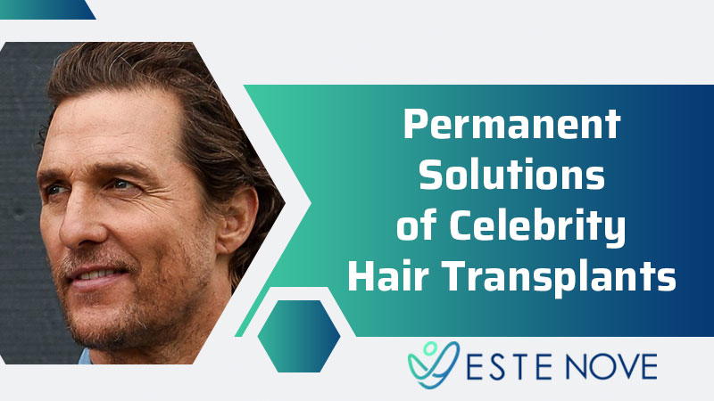 Permanent Solutions Of Celebrity Hair Transplants