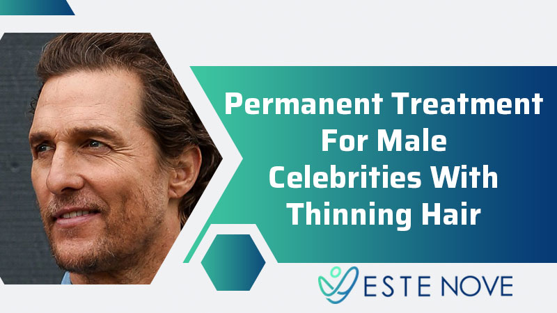 Permanent Treatment For Male Celebrities With Thinning Hair