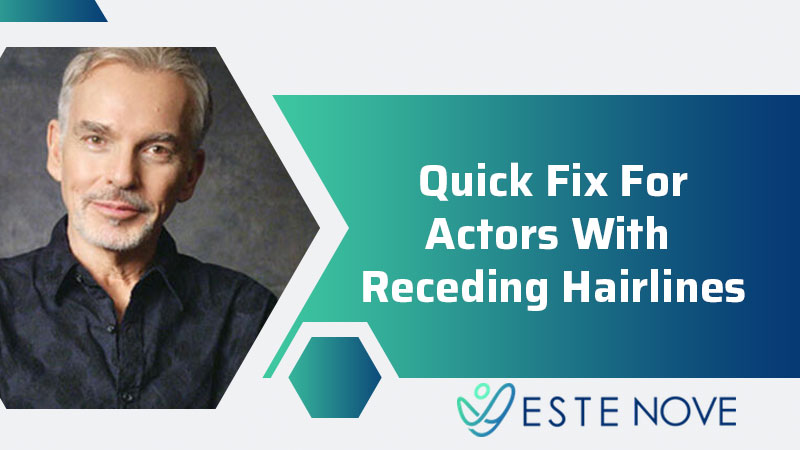 Quick Fix For Actors With Receding Hairlines