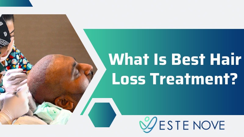 What Is Best Hair Loss Treatment?
